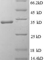 Human Interleukin-1 family member 10 (IL1F10) Recombinant Protein - BioCrest Sci