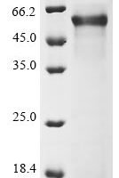 Human Plexin-B1 (PLXNB1), partial Recombinant Protein - BioCrest Sci
