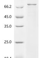 Human RNA-binding protein FXR1 (FXR1) Recombinant Protein, N-SBP/C-10His - BioCrest Sci