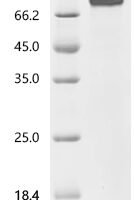 Macaca fascicularis receptor protein-tyrosine kinase, partial Recombinant Protein - BioCrest Sci
