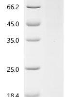 Human Importin subunit beta-1 (KPNB1) Recombinant Protein, C-His, aa 1–876, Yeast - BioCrest Sci
