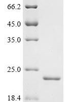 Human Bromodomain adjacent to zinc finger domain protein 2B (BAZ2B), partial Recombinant Protein - BioCrest Sci