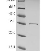 Helicobacter pylori Cytotoxicity-associated immunodominant antigen (cagA), partial Recombinant Protein - BioCrest Sci