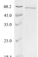 Human Cytochrome P450 3A7 (CYP3A7) Recombinant Protein - BioCrest Sci
