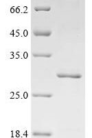 Streptococcus mutans serotype c Glucosyltransferase-I (gtfB), partial Recombinant Protein - BioCrest Sci