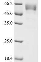 Mouse Gamma-synuclein  (Sncg) Recombinant Protein - BioCrest Sci