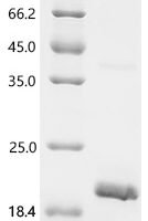Mouse Probetacellulin (Btc), partial Recombinant Protein, C-His - BioCrest Sci