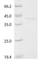 Influenza B virus Nucleoprotein (NP), partial Recombinant Protein, N-10His/C-Myc - BioCrest Sci
