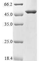 Mouse Lipoprotein lipase (Lpl) Recombinant Protein - BioCrest Sci