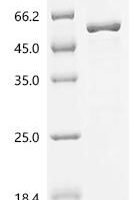 Mouse 1,25-dihydroxyvitamin D(3) 24-hydroxylase, mitochondrial(Cyp24a1) Recombinant Protein - BioCrest Sci