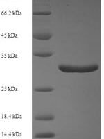 Human Calmodulin-like protein 5 (CALML5) Recombinant Protein - BioCrest Sci