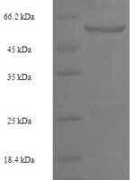 Human Receptor-type tyrosine-protein phosphatase beta (PTPRB), partial Recombinant Protein - BioCrest Sci