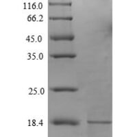 Human Secretory phospholipase A2 receptor (PLA2R1), partial Recombinant Protein, N-His-Myc - BioCrest Sci