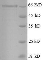 Mouse Glutamate decarboxylase 2 (Gad2) Recombinant Protein - BioCrest Sci