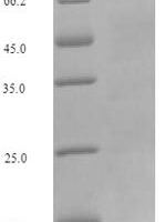 Mouse Kelch-like ECH-associated protein 1 (Keap1) Recombinant Protein, N-His-SUMO - BioCrest Sci