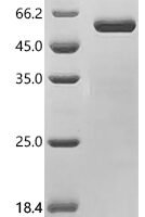 Human Ciliary neurotrophic factor (CNTF) Recombinant Protein, C-hFc1 - BioCrest Sci