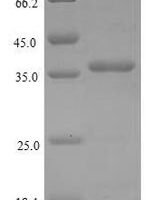 Drosophila melanogaster Protein bottleneck (bnk) Recombinant Protein - BioCrest Sci