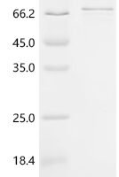 Human Polypeptide N-acetylgalactosaminyltransferase 14 (GALNT14) Recombinant Protein, C-His - BioCrest Sci