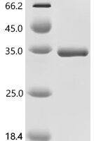 Human DnaJ homolog subfamily B member 6 (DNAJB6) Recombinant Protein, C-His, aa 2–241, E.coli - BioCrest Sci
