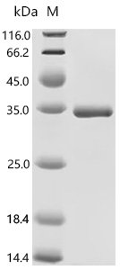 Human DnaJ homolog subfamily B member 6 (DNAJB6) Recombinant Protein, C-His, aa 2–241, E.coli, Homo sapiens (Human), E.coli, C-terminal 6xHis-tagged, 33.7 kDa, purity >≥ 90% as determined by SDS-PAGE.