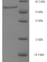Human Dual specificity mitogen-activated protein kinase kinase 6 (MAP2K6) Recombinant Protein, N-His-SUMO - BioCrest Sci