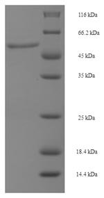 Human Dual specificity mitogen-activated protein kinase kinase 6 (MAP2K6) Recombinant Protein, N-His-SUMO, Homo sapiens (Human), E.coli, N-terminal 6xHis-SUMO-tagged, 53.5 kDa, purity >≥ 90% as determined by SDS-PAGE.