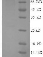 Human Glycogen phosphorylase, liver form (PYGL), partial Recombinant Protein - BioCrest Sci