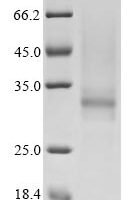 Human Tryptase beta-2 (TPSB2) Recombinant Protein - BioCrest Sci