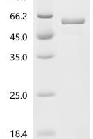 Rat RNA-binding protein Nova-1 (Nova1) Recombinant Protein, C-His, aa 1–474, E.coli - BioCrest Sci