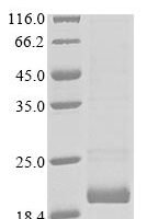 Human C-C chemokine receptor type 4 (CCR4), partial Recombinant Protein - BioCrest Sci