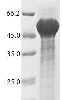 Mouse Decorin (Dcn), partial Recombinant Protein, N-His-SUMO - BioCrest Sci