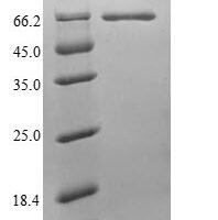 Human Endogenous retrovirus group K member 6 Env polyprotein (ERVK-6), partial Recombinant Protein, N-His, aa 90–632, E.coli - BioCrest Sci