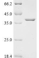 Escherichia coli N-acetylmuramoyl-L-alanine amidase AmiD (amiD) Recombinant Protein, C-His - BioCrest Sci