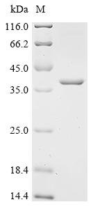 Escherichia coli N-acetylmuramoyl-L-alanine amidase AmiD (amiD) Recombinant Protein, C-His, Escherichia coli (strain K12), E.coli, C-terminal 6xHis-tagged, 36.2 kDa, purity >≥ 90% as determined by SDS-PAGE.