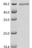 Influenza A virus Nucleoprotein (NP) Recombinant Protein, C-His - BioCrest Sci