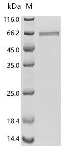 Influenza A virus Nucleoprotein (NP) Recombinant Protein, C-His, Influenza A virus (strain A/USA:Albany/12/1951 H1N1), Baculovirus, C-terminal 6xHis-tagged, 58.9 kDa, purity >≥ 95% as determined by SDS-PAGE.≥ 95% as determined by SEC-HPLC.