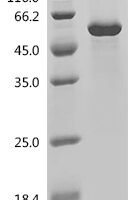 Human Adhesion G protein-coupled receptor L3 (ADGRL3), partial Recombinant Protein, C-His, aa 20–425, E.coli - BioCrest Sci