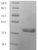 Human Histone H2A.V (H2AFV) Recombinant Protein - BioCrest Sci