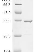 Paraclostridium sordellii 7alpha-hydroxysteroid dehydrogenase Recombinant Protein - BioCrest Sci