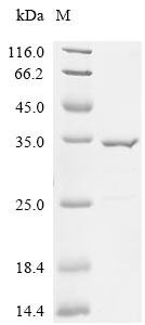 Paraclostridium sordellii 7alpha-hydroxysteroid dehydrogenase Recombinant Protein, Paraclostridium sordellii (Clostridium sordellii), E.coli, C-terminal 6xHis-tagged, 36.1 kDa, purity >≥ 90% as determined by SDS-PAGE.