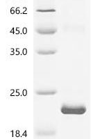 Human Isoaspartyl peptidase/L-asparaginase (ASRGL1), partial Recombinant Protein - BioCrest Sci