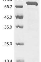 Human G1/S-specific cyclin-D3 (CCND3), Biotinylated Recombinant Protein - BioCrest Sci