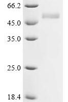 Varicella-zoster virus Envelope glycoprotein L (gL) Recombinant Protein - BioCrest Sci