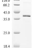 Rabbit Fibronectin (FN1), partial Recombinant Protein - BioCrest Sci
