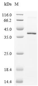 Rabbit Fibronectin (FN1), partial Recombinant Protein, Oryctolagus cuniculus (Rabbit), E.coli, N-terminal 6xHis-tagged, 40.3 kDa, purity >≥ 95% as determined by SDS-PAGE.