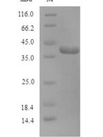 Human N-glycosylase/DNA lyase (OGG1) Recombinant Protein, N-His, aa 1–345, Yeast - BioCrest Sci