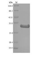 Cynodon dactylon Profilin (PRO1) Recombinant Protein - BioCrest Sci