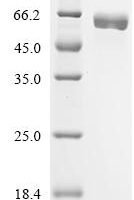 Escherichia coli Trehalose-6-phosphate synthase (otsA) Recombinant Protein, C-10His - BioCrest Sci