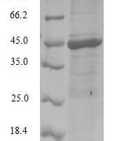 Human NEDD8 (NEDD8) Recombinant Protein - BioCrest Sci