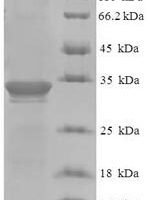 Human Dysbindin domain-containing protein 2 (DBNDD2) Recombinant Protein - BioCrest Sci